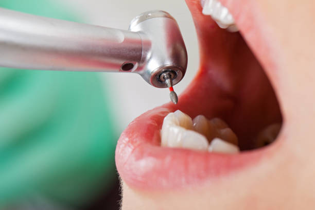 Best Pediatric Emergency Dentist in North Bellmore, NY